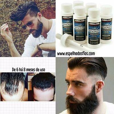 МИНОКСИДИЛ КИРКЛАНД - 5% (оригинал) В ТАШКЕНТЕ   - 399 000 so'm / dona