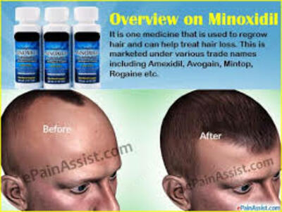 399 000 so'm / dona МИНОКСИДИЛ КИРКЛАНД - 5% (оригинал) В ТАШКЕНТЕ