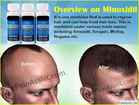 399 000 сум МИНОКСИДИЛ КИРКЛАНД - 5% (оригинал) В ТАШКЕНТЕ