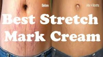 115 000 сум / шт. КРЕМ ПРОТИВ РАСТЯЖЕК DANJIA SNAIL REMOVE STRETCH MARKS