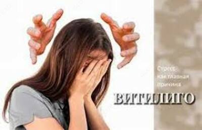 КОМПЛЕКС СПЕЦИАЛЬНЫХ ВОССТАНАВЛИВАЮЩИХ СРЕДСТВ ДЛЯ ВИТИЛИГО (НАБОР ЗМЕЯ) ВЫРАБАТЫВАЕТ МЕЛАНИН (КОЖНЫЙ ПИГМЕНТ) - 169 000 сум / шт.