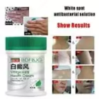 Vitiligo davolash uchun damlamasi 50ml