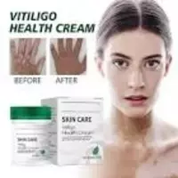 Vitiligo davolash uchun damlamasi 50ml - 149 000 so'm