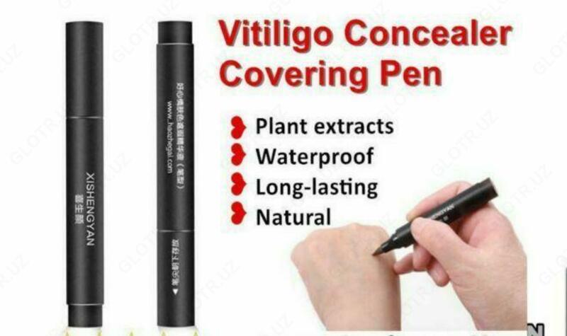 XISHENGYAN FLAMASTER VITILIGO