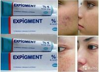 "Экспигмент" отбеливающий крем - 97 000 сум