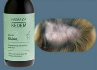 Препарат от выпадения и для восстановления роста волос GADAL