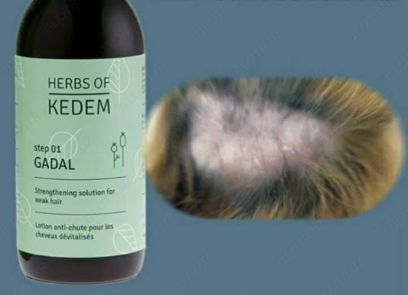 Препарат от выпадения и для восстановления роста волос GADAL