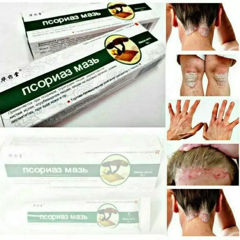 ПСОРИАЗ МАЗЬ-КИТАЙСКОЕ СРЕДСТВО ОТ КОЖНОГО НЕДУГА (15 Г)