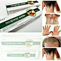 ПСОРИАЗ МАЗЬ-КИТАЙСКОЕ СРЕДСТВО ОТ КОЖНОГО НЕДУГА (15 Г) - 97 000 сум