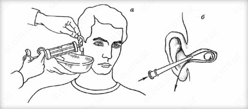 Промывание наружного слухового прохода - по запросу