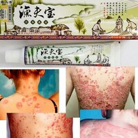 Мазь «Сокровище рыбака» от псориаза