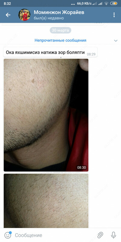 Оригинал Миноксидил Канада Израиль! - от {0} сум