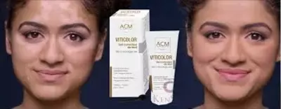 Viticolor gel uz - 419 000 so'm / dona