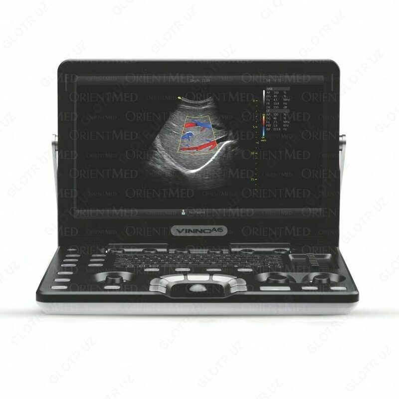 Узи аппарат Vinno A6