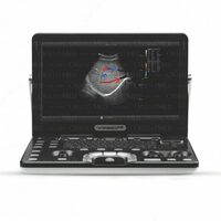 Узи аппарат Vinno A6