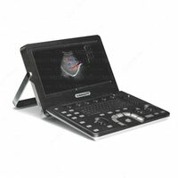  Узи аппарат Vinno A6 - 