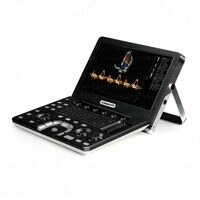   Узи аппарат Vinno A6