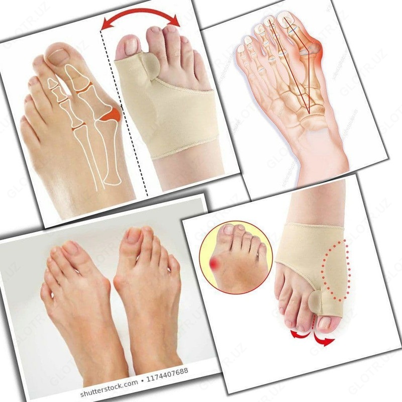 Фиксатор для большого пальца ноги Valgus - 75 000 сум