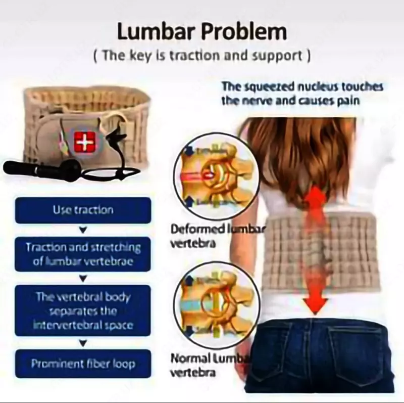 Orqa miya havo tortish kamari Chakana savdo