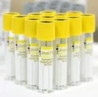 Вакуумная пробирка с желтой крышкой с активатором свертывания и разделительным гелем