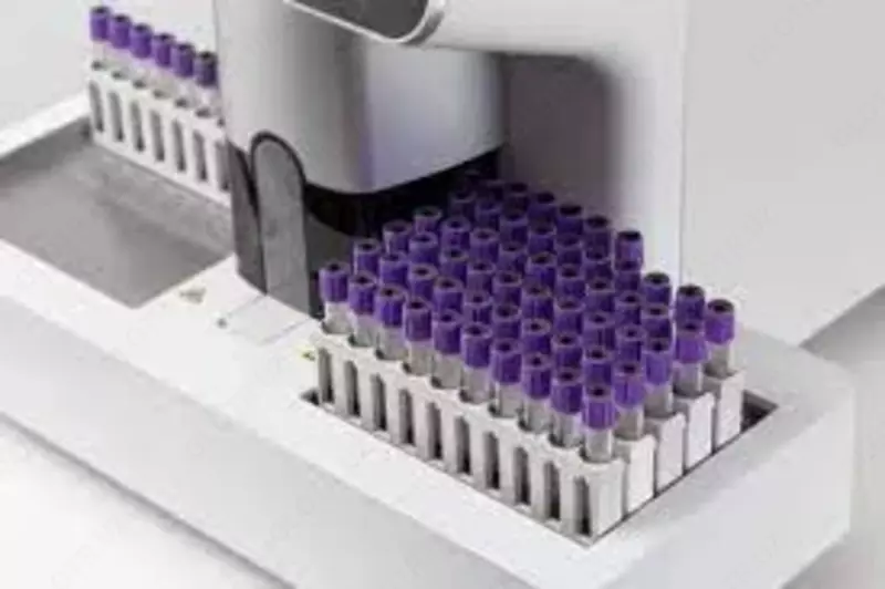 ANALIZER GEMATOLOGIYASI AVTOMAT (5-differensial tahlil) ADF bilan "H60S" - по запросу