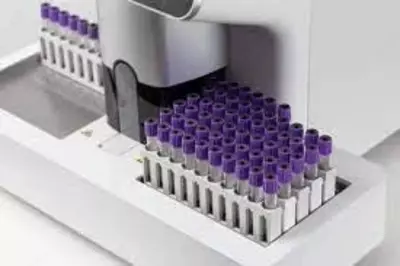 АНАЛИЗАТОР ГЕМАТОЛОГИЧЕСКИЙ АВТОМАТ (5-дифференциальный анализ) «H60S» с автоподатчиком - Цена по запросу