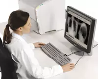 Digitayzer (raqamlashtirgich) Agfa CR 15-X - 250 000 000 so'm