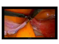 Jusha E550DG профессиональный 55-дюймовый 4K хирургический монитор