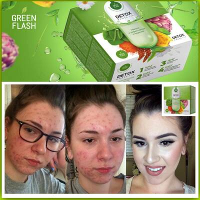 Очищающие Капсулы Nl Кейс Detox Box - 382 000 сум / шт.