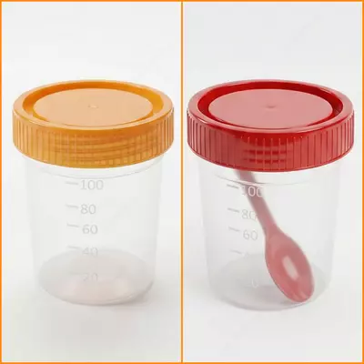 Biomateriallarni yig‘ish uchun konteyner (siydik va najas uchun) 100 ml