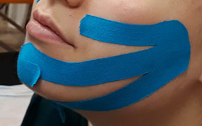 Тейпирование в логопедии - 1 200 сум