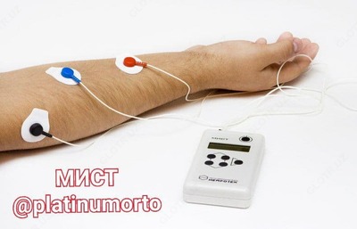 МИСТ ЭЛЕКТРОСТИМУЛЯТОР