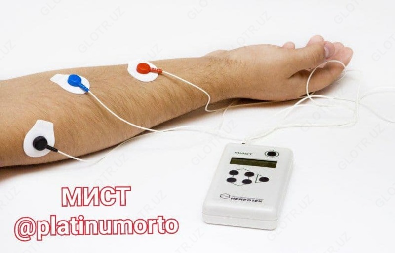 MIST ELEKTROSTIMULYATOR