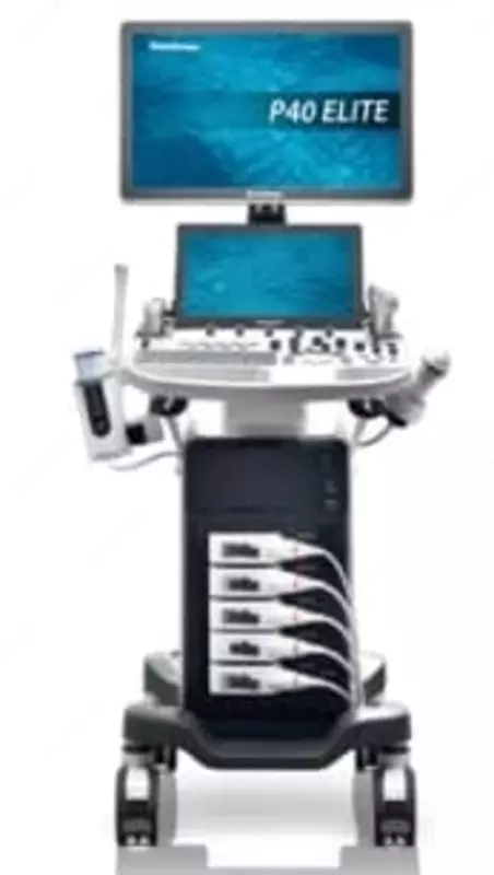 SonoScape P40 Elite Ultrasonik diagnostika tizimi - по запросу