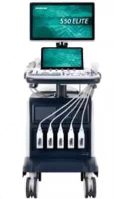 SonoScape S50 Elite ultratovush diagnostika tizimi