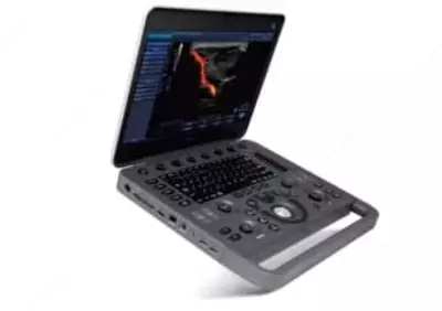 SonoScape X3 Портативный Ультразвуковая диагностическая система - Цена по запросу