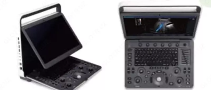 SonoScape E3 Портативный Цветового доплера для ультразвуковой диагностики - по запросу