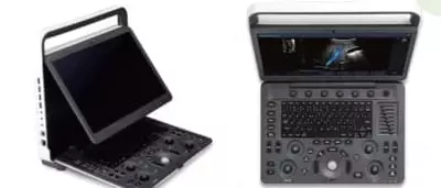 SonoScape E3 Портативный Цветового доплера для ультразвуковой диагностики - Цена по запросу