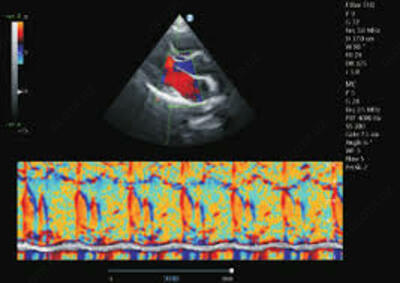Система Ультразвуковая Диагностическая  Только оптом