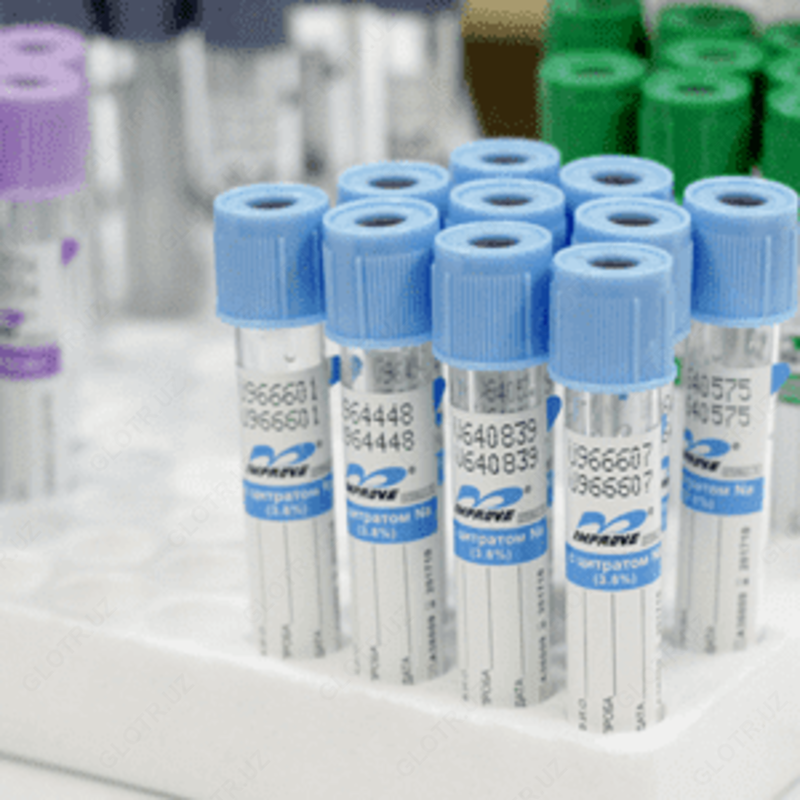 Вакумные пробирки Improvacuter с Цитрат натрия 3,2% (голубая крышка)