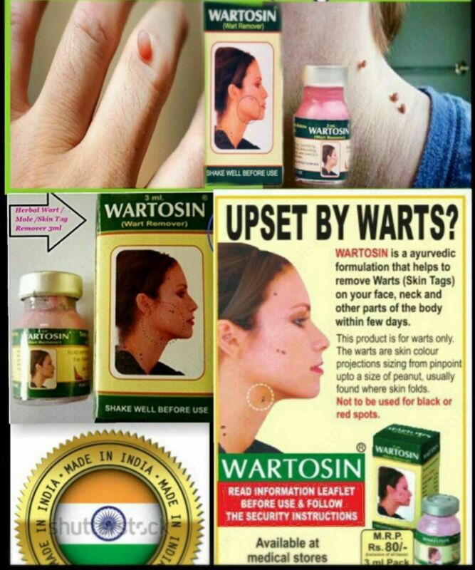 Wartosin - Вартосин (удаление бородавок и папиллом на лице