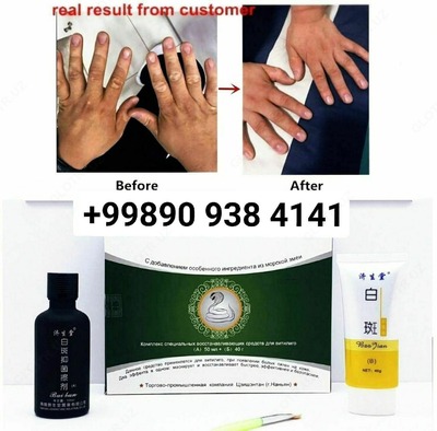 Набор( крем и лосьон) для лечения "Витилиго"