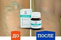 199 000 сум VARICREAM varizokni davosi