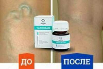 199 000 сум / шт. VARICREAM varizokni davosi