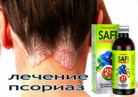 Safi-psariaz uchun - 150 000 сум