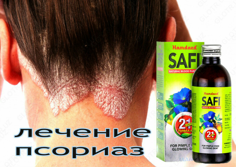 Safi-psariaz uchun - 150 000 сум