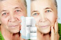 Удаление морщин на лице с помощью нано-ботокса Kasmetika.uz