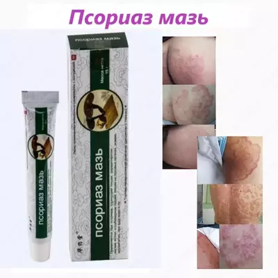 Мазь против псориаза Только в розницу