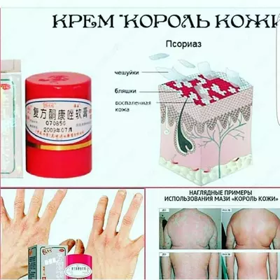 ТАЙСКАЯ МАЗЬ КОРОЛЬ КОЖИ ОТ ПСОРИАЗА - 99 000 сум / шт.