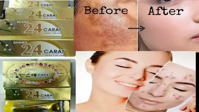Davolovchi krem Derma 24 Carat (Teri kasalliklari uchun) - 150 000 so'm / dona